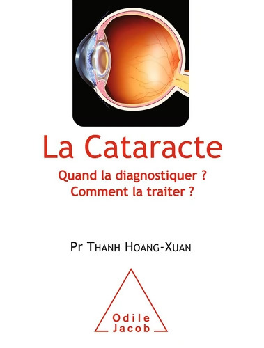 La Cataracte : Quand la diagnostiquer ? Comment la traiter ? - Thanh Hoang-Xuan